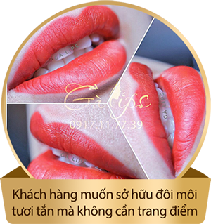 khachhang3